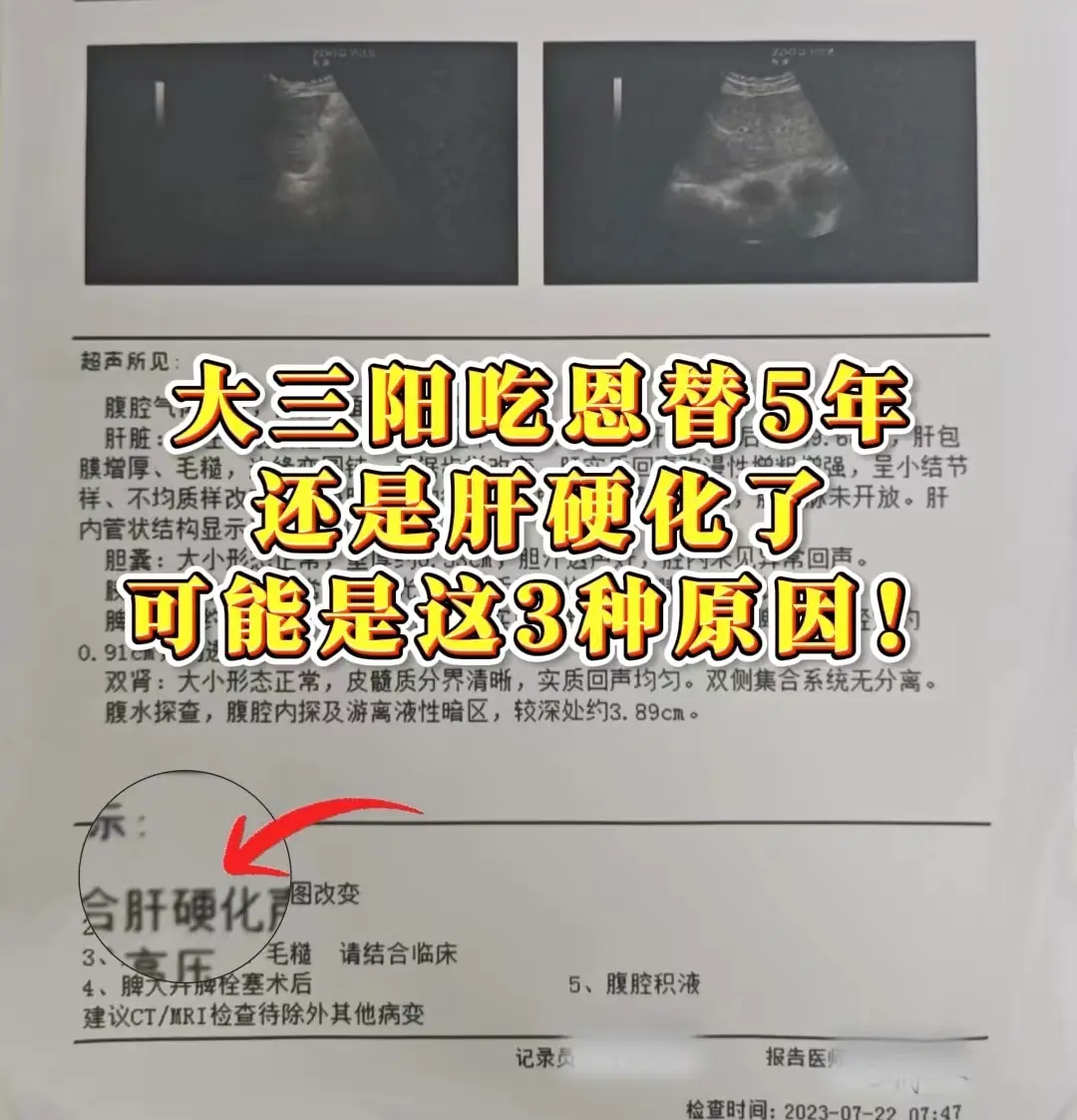 在临床上经常遇到刚刚确诊肝硬化的患者问我：教授，为什么之前一直坚持吃抗...