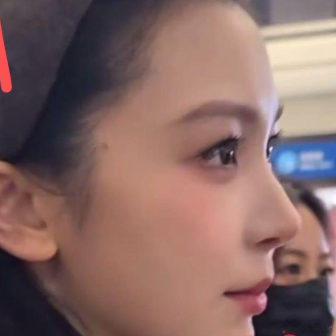 近期，艺人易梦玲的面部变化引发公众讨论，其本人已就相关传闻作出回应。易梦玲近期面