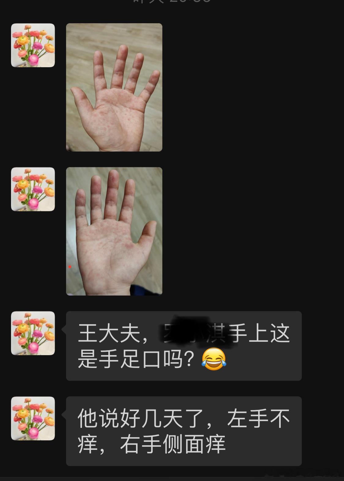 手心红色皮疹。根据部位：手心；颜色：红；感受：痒。可判断为：心  、热 、心火。