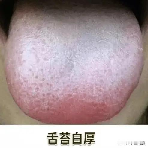 一看舌苔又白又腻，就用附子理中丸？为啥会没效果，这样调效果翻倍
 病人主诉：乏力