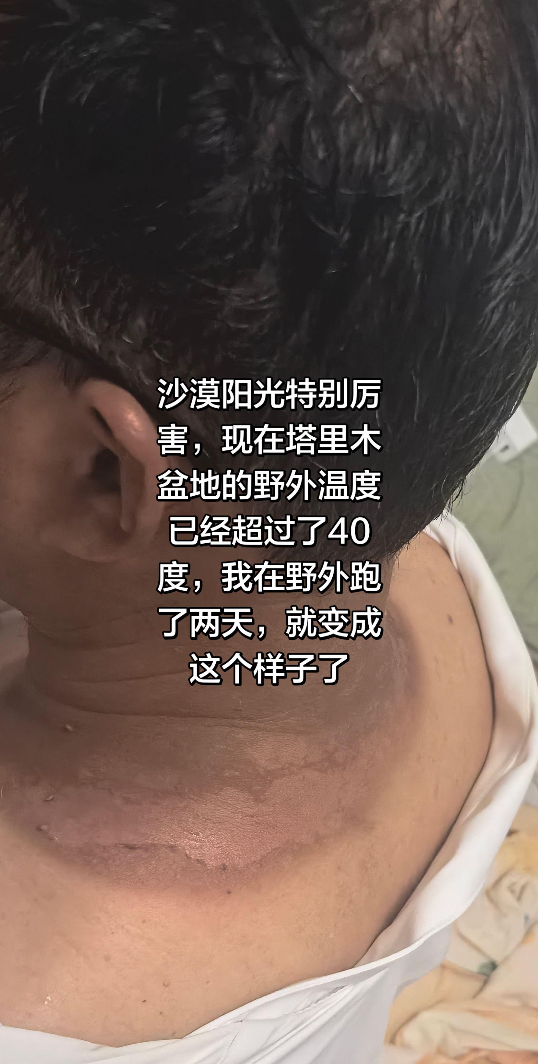 塔里木盆地的阳光很厉害沙漠阳光阳光灼伤