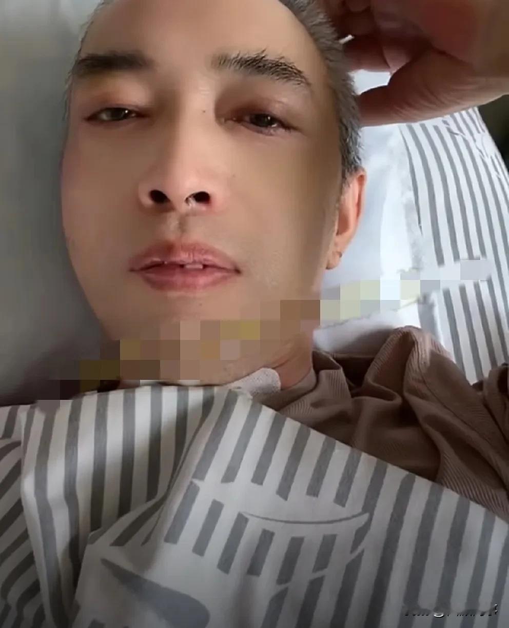 “迪爸”苏醒出镜，感动落泪。

               “迪爸”车祸手术治