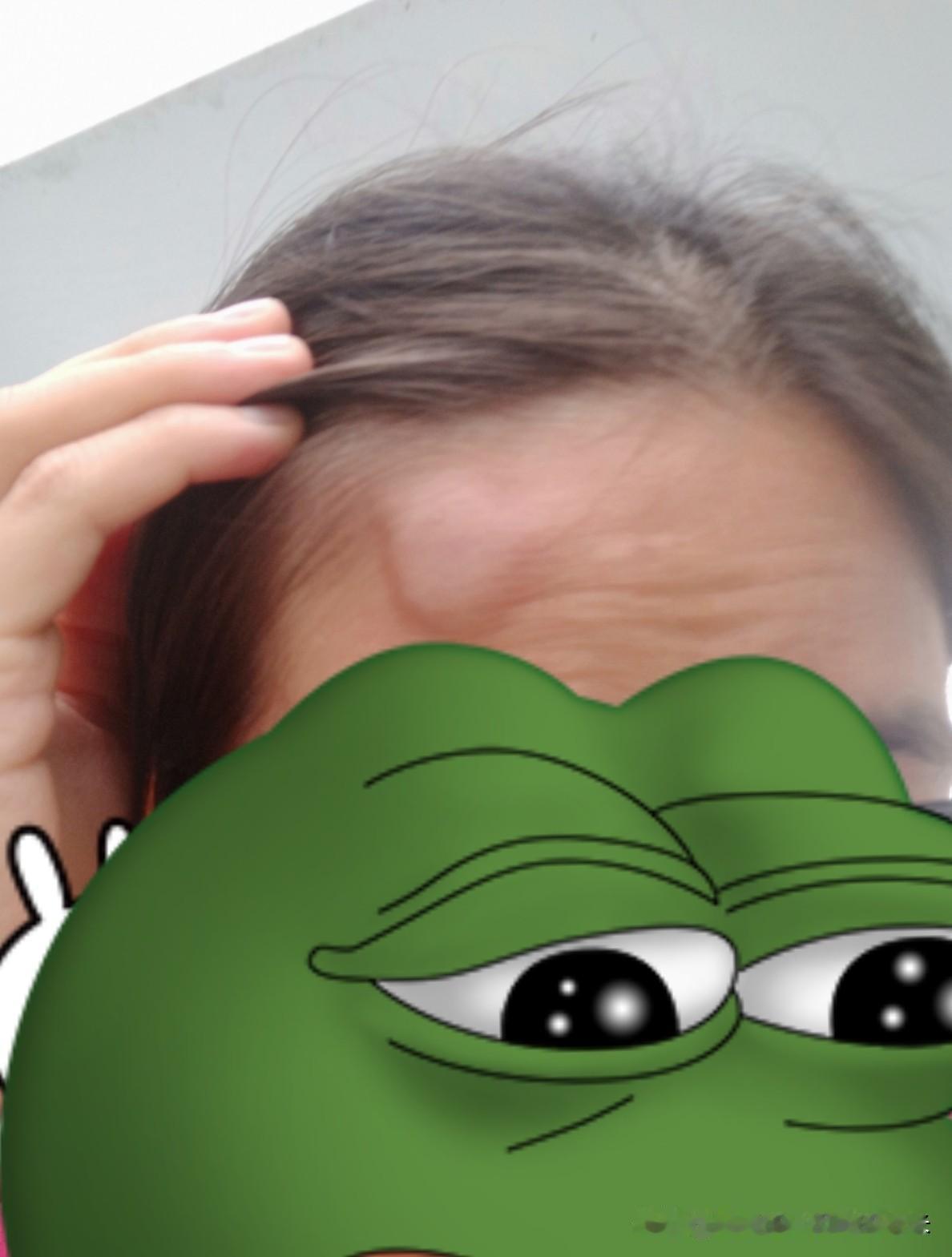 分享我这周有趣的事：这不是趣事，是一件悲惨的事[流泪]