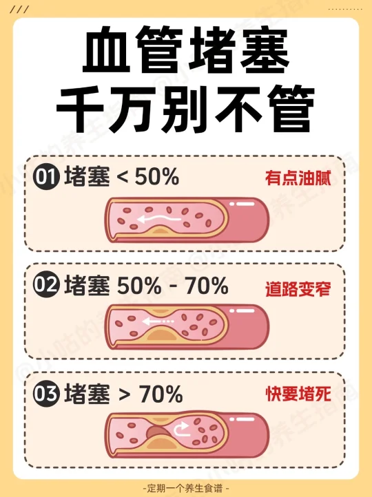 警惕血管堵塞！高血脂提高警惕了