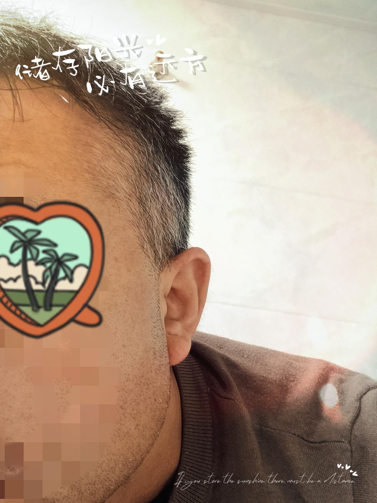 白发三万棵，还长这么长。不知万青丝，何时染了霜。岁月是把杀猪刀，却刀刀砍向我。年