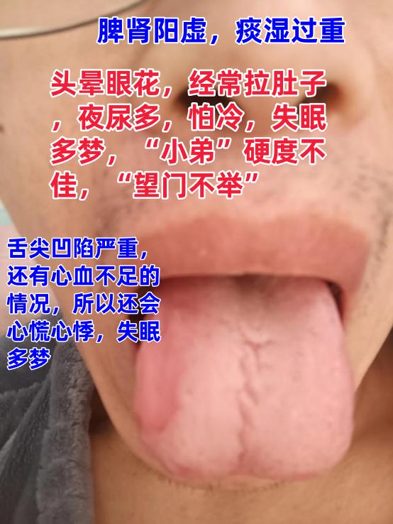 应粉丝要求，每天看舌20个！

    “有诸内必行于诸外！
通过看舌，可以知五