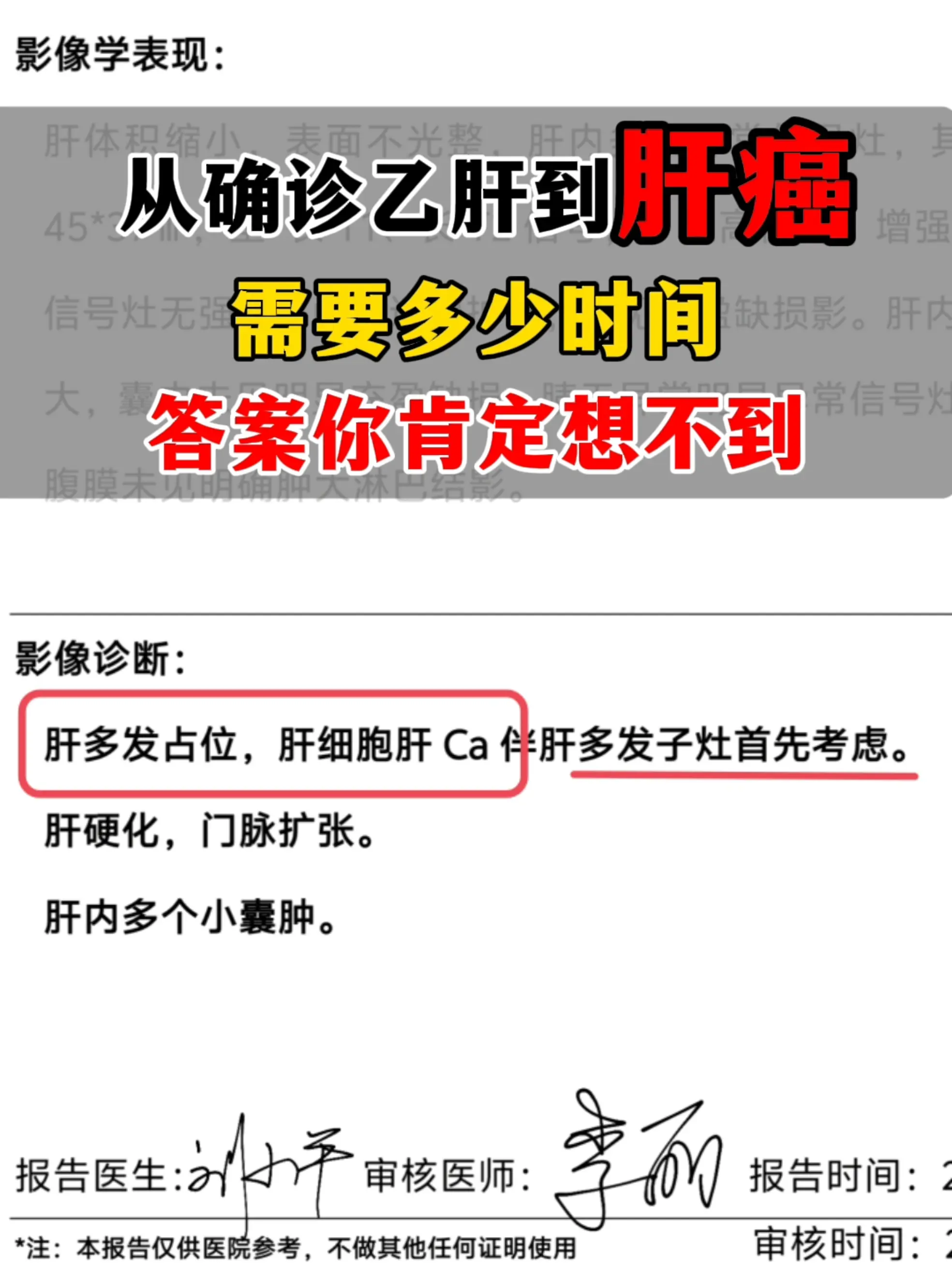肝癌始终是悬在肝病患者头上的一把剑啊，尤其是对乙肝来说：90%的肝癌都...