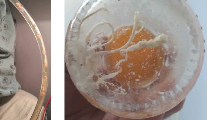 这里堵，那里堵，还溶不掉。 