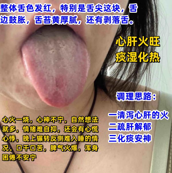 今日舌诊案例分析，每天学习一点点，看着看着就会了[给力][给力][给力]

1.