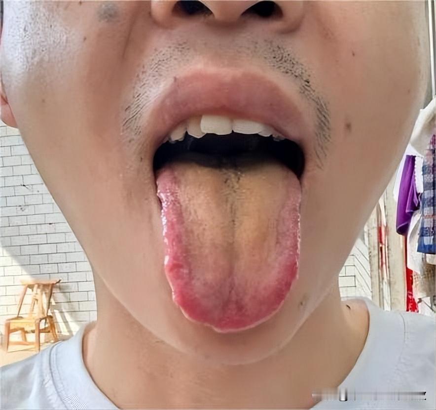 天气燥了你们也开始“造”了？你看看这家伙造的，又是上火又是肾虚的[发怒][发怒]