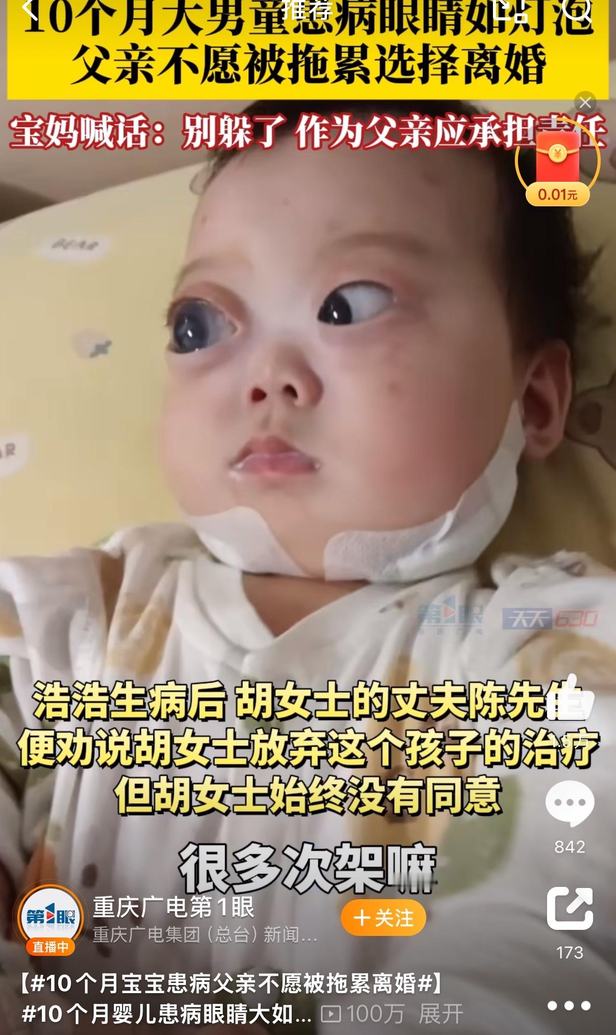 10个月宝宝患病父亲不愿被拖累离婚也就是说一生下来就提了离婚，离了以后也不给治疗
