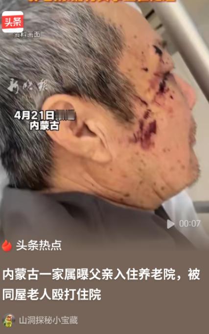 “必须严惩！”内蒙古赤峰，女子将丈夫送到养老院，几天后接丈夫，只见丈夫裤子直接裂