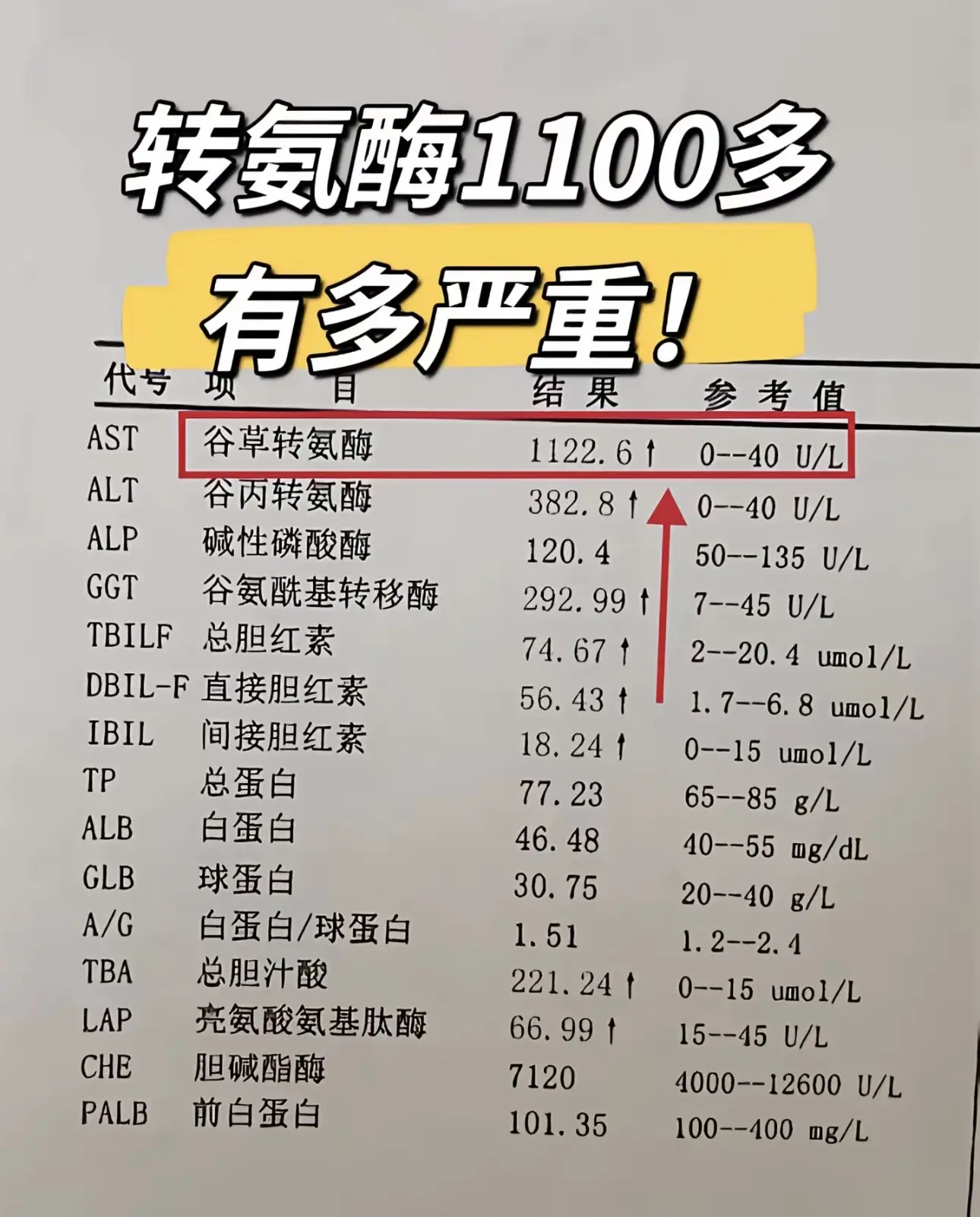 转氨酶1100多有多严重！多高算高。转氨酶正常情况下是0~40之间，如...
