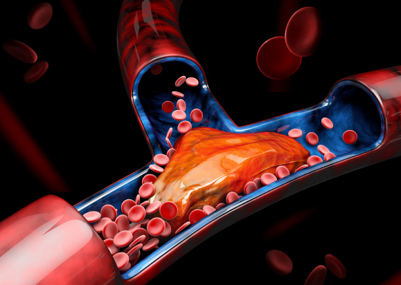 医生从濒死患者动脉掏血栓如同掏碎肉遇见好的医生真的是修来的福气，想起那几个小孩我