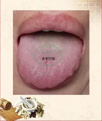 知道为啥你身体难调理吗？都是拖出来的！

我们来看这位朋友，就是典型的拖出来的病