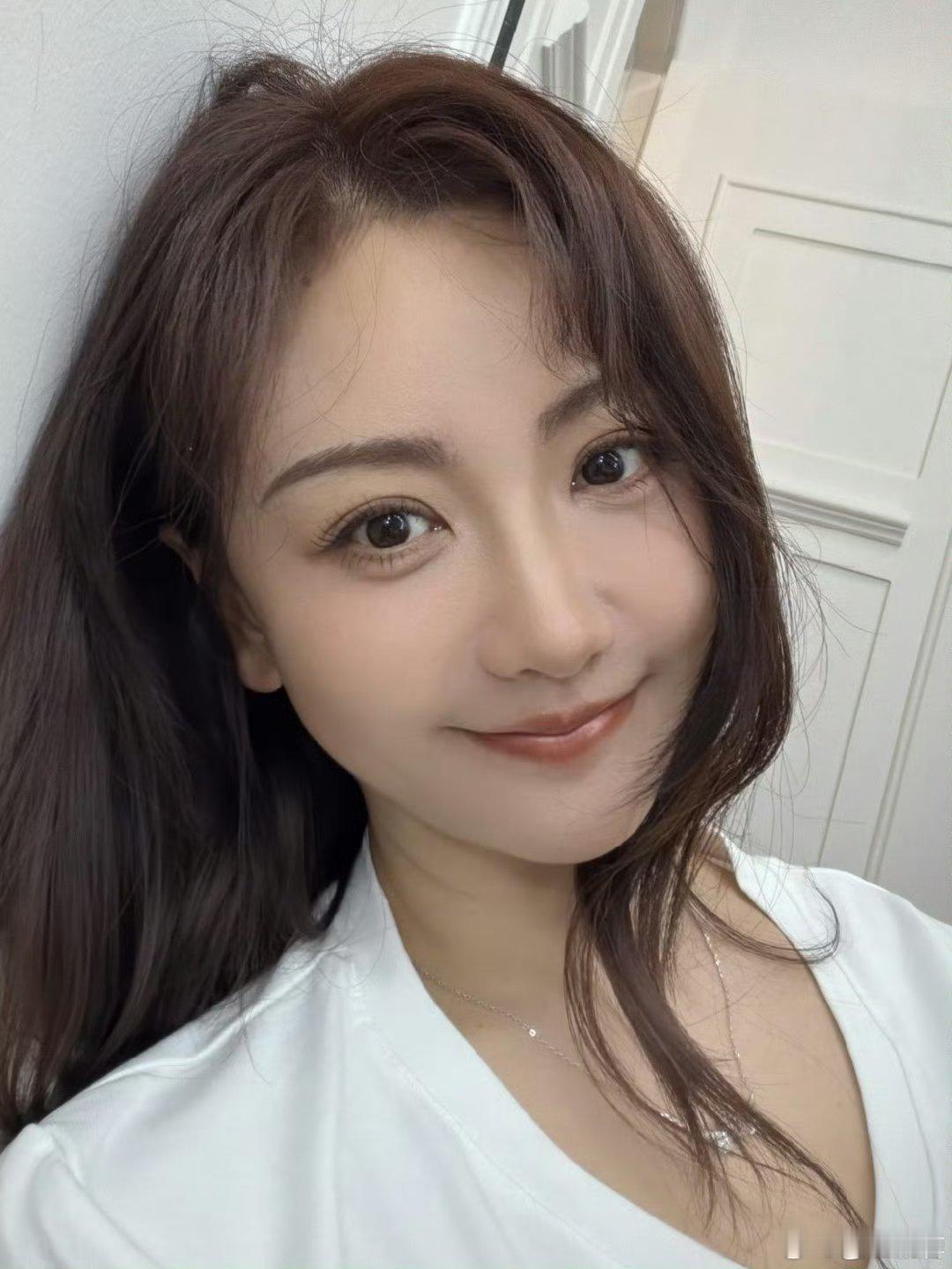 杨蓉面部烫伤恢复近照现在的状态超级好，自信的女人果然最美！ 