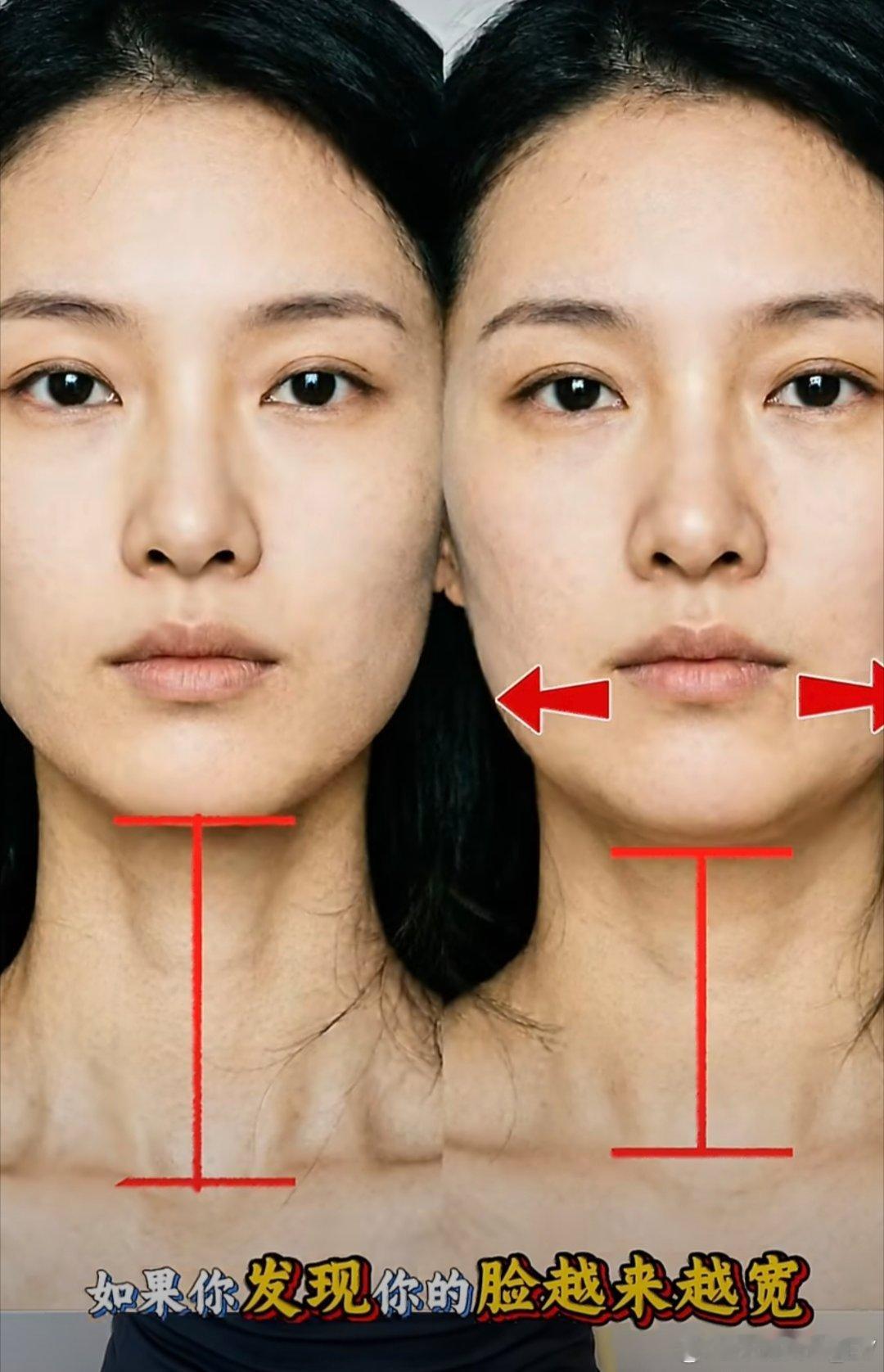 原来驼背会让脸变大体态真的会影响颜值啊，我最近发现我体态有极大的问题，看来要办健