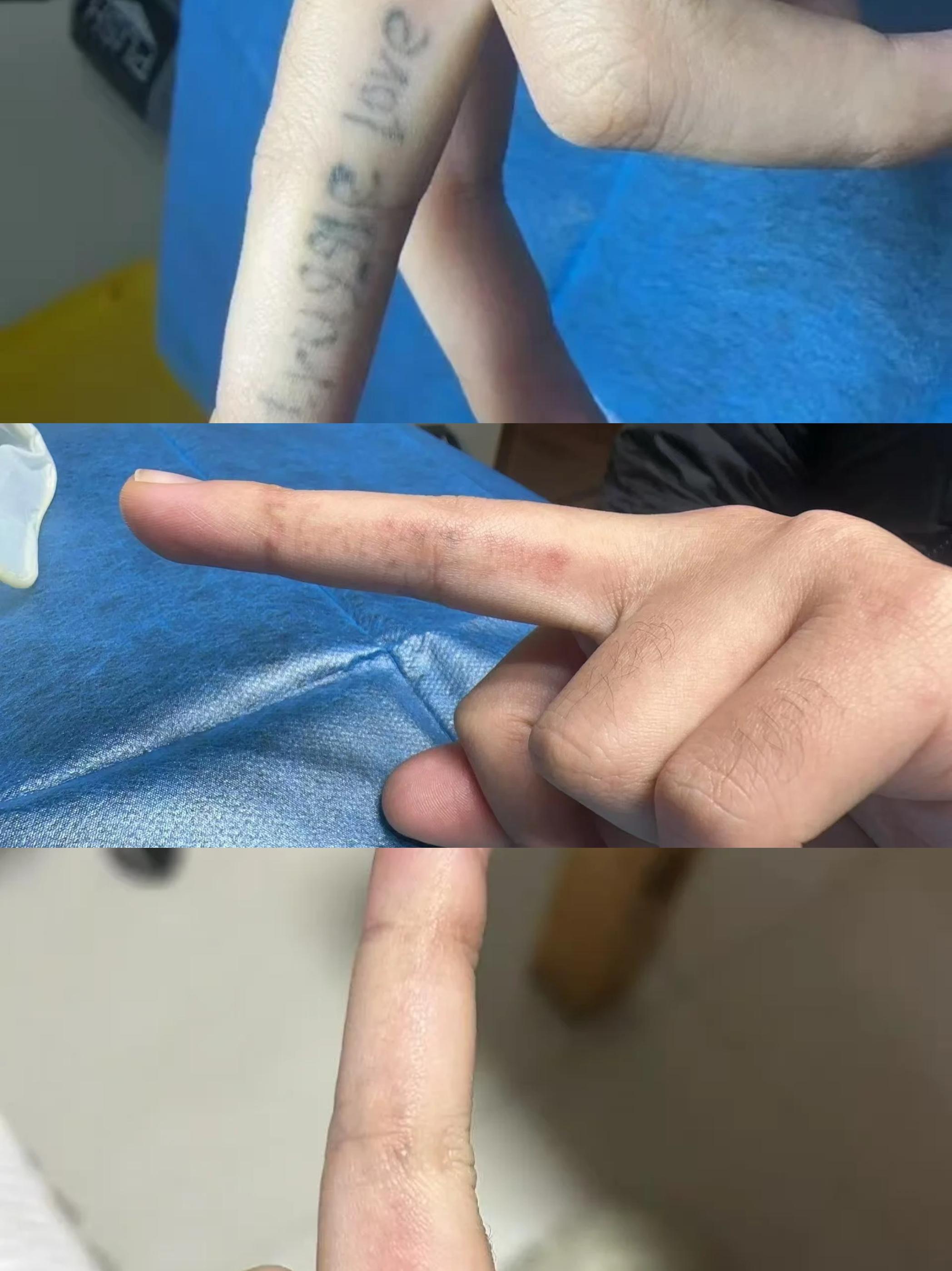 小小的我非主流的纹身，开智以后的第一件事就是去洗掉🤣多谢当时纹身师给...