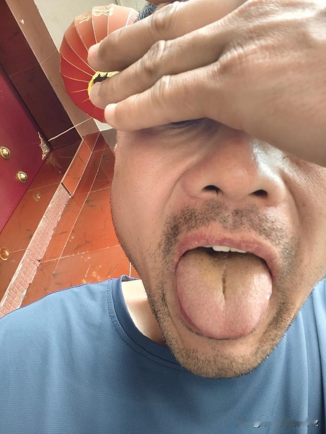 这大哥，直接把脸都当起来了，也不知道害羞啥[捂脸][捂脸][捂脸]
主诉：尿频尿