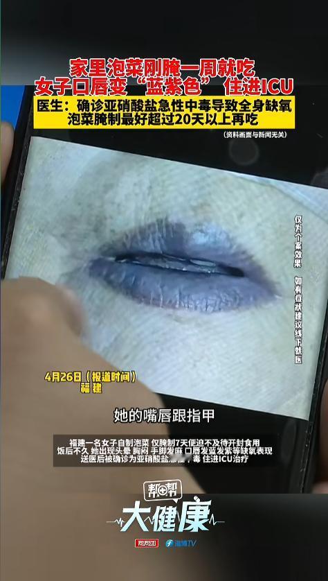 “可不能胡乱吃！”4月26日报道，福建，一急诊室主任分享了近期的一个病例。一名女