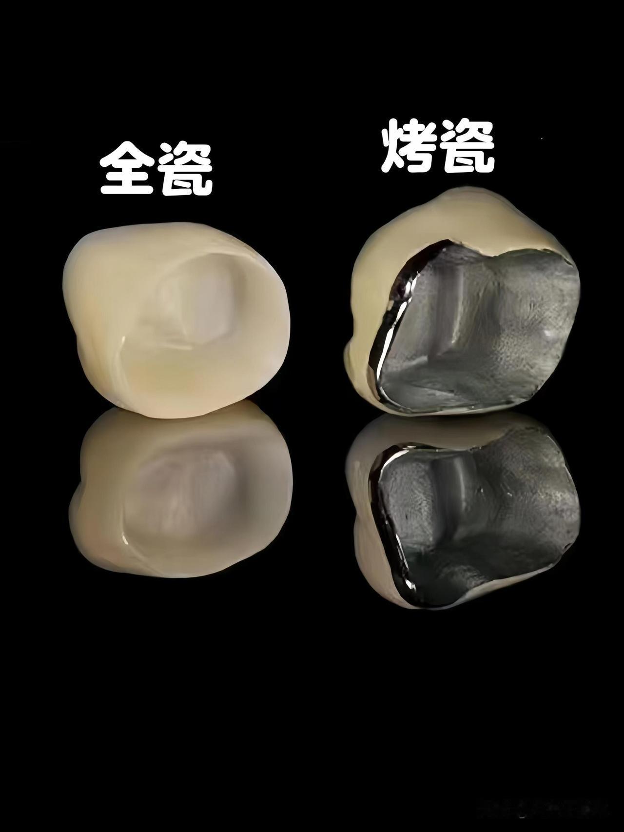 晚上好！友友们，前不久牙齿做了一个根管治疗，下个星期准备做一个牙冠保护，做牙冠的