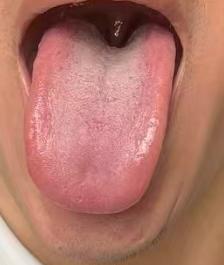 肝郁气结筋络拘滞，疏肝舒展筋脉调和宗筋状态








如何可以大幅度提升海