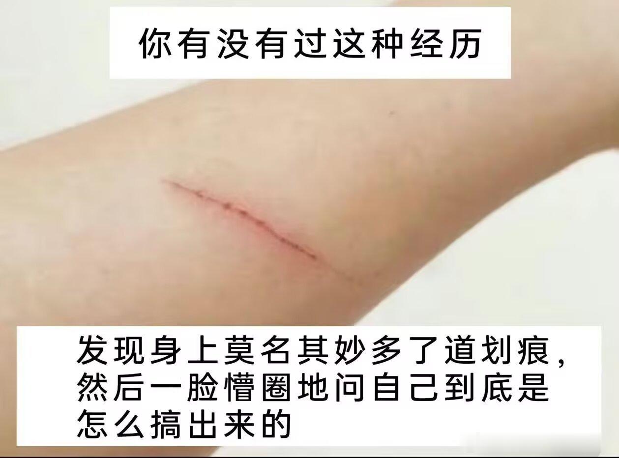 2084洗澡的时候突然痛了一下 