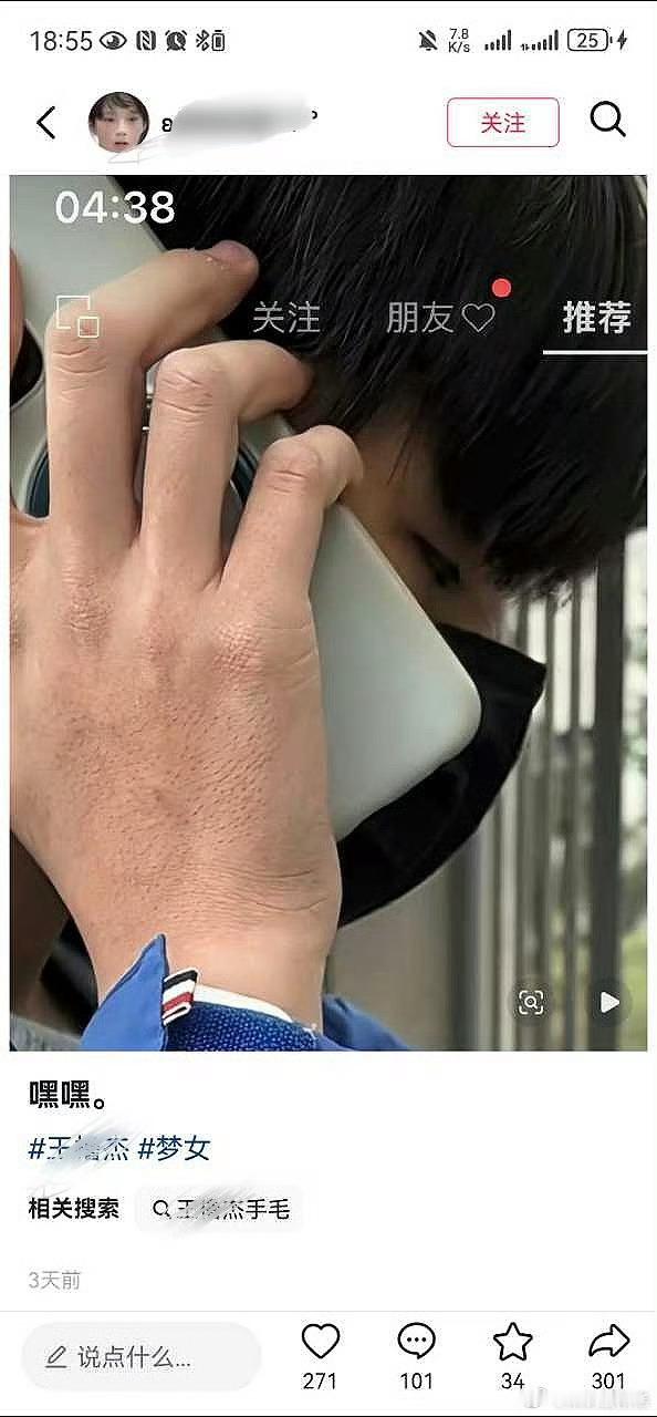 好恐怖 16岁少男的手竟然是这样的 与其背后的隐私离不开吧？是不是得了什么说不出