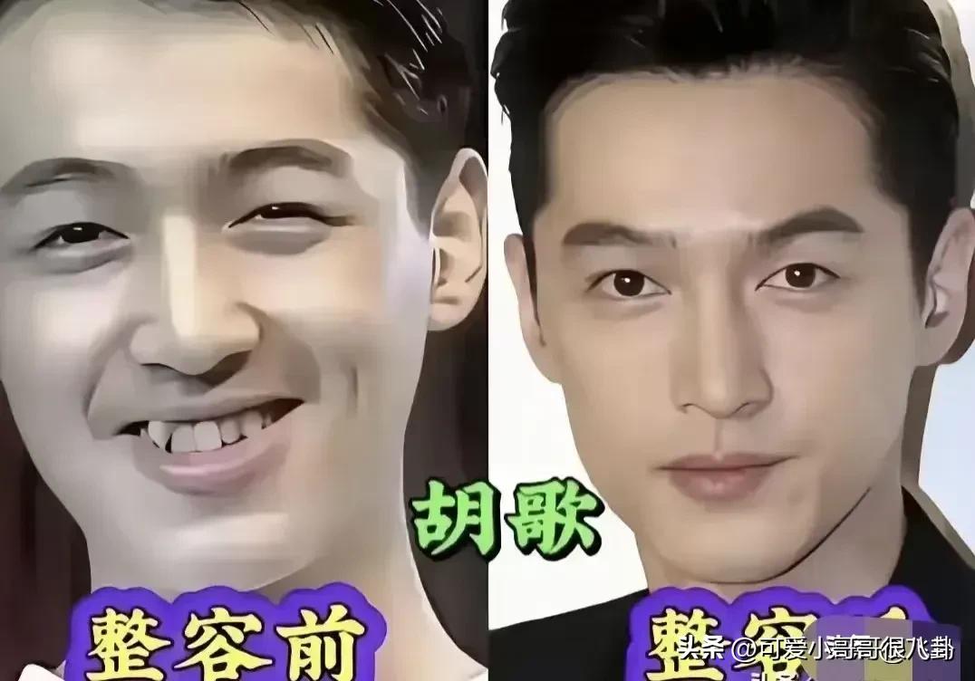 整容后的男明星，看起来确实是精致了很多！
原来不只是女生会在意容貌，男生同样也有