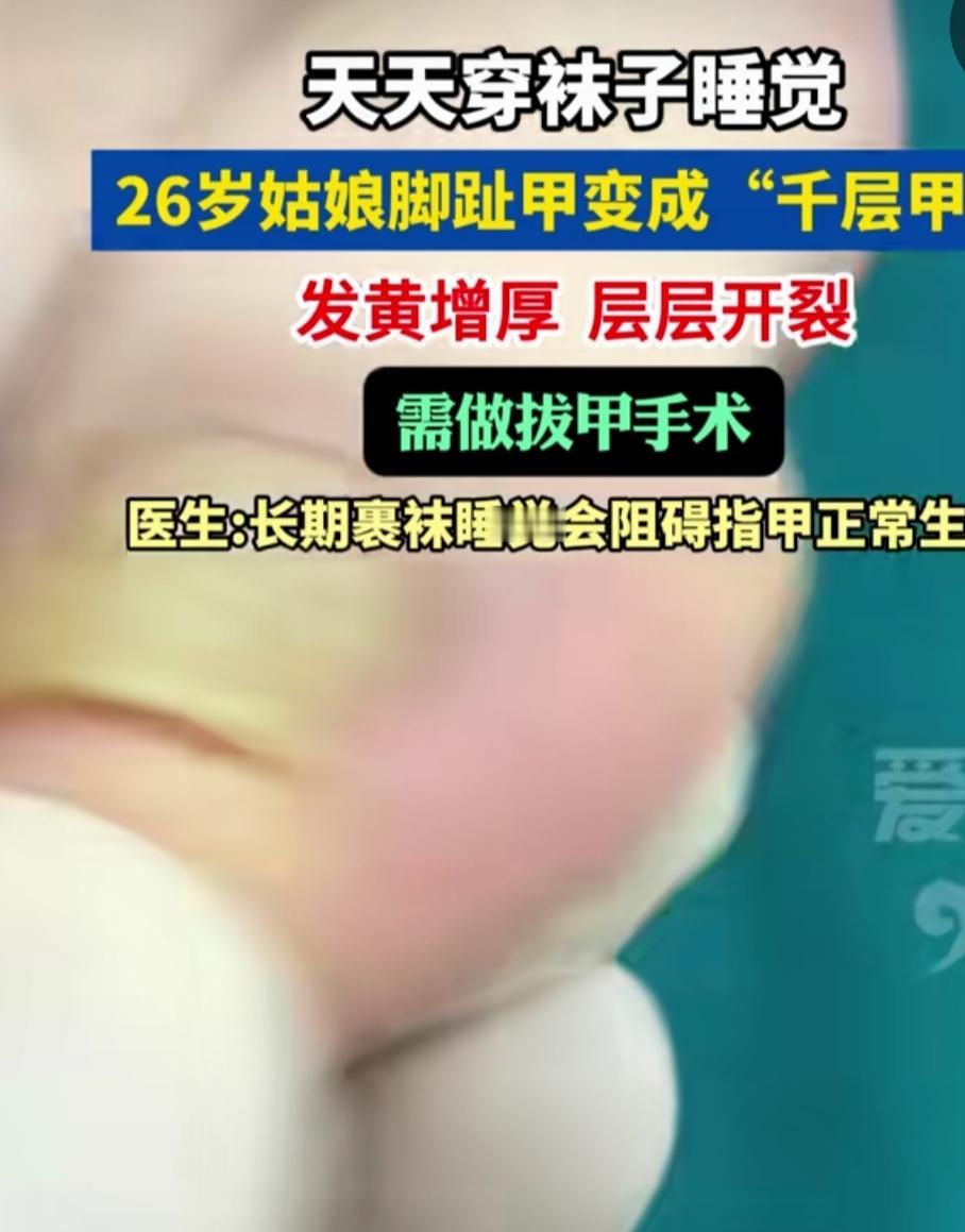 女孩子26岁，穿着袜子，冬天睡觉阻碍了指甲的生长，渐渐指甲变厚了，变得像灰指甲一