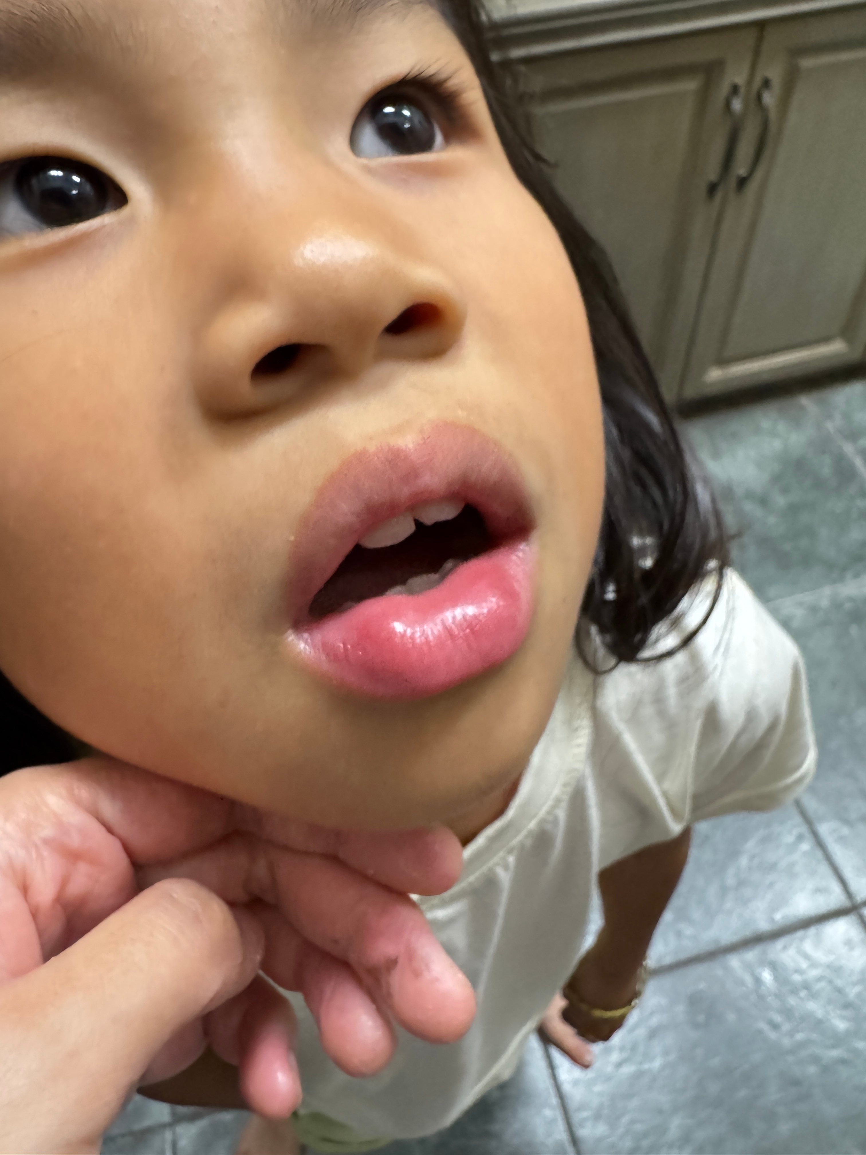 妈耶，她说虫子爬她嘴唇上了👄，感觉好痒，赶快给她清水洗了洗，又冷敷了一会儿，再