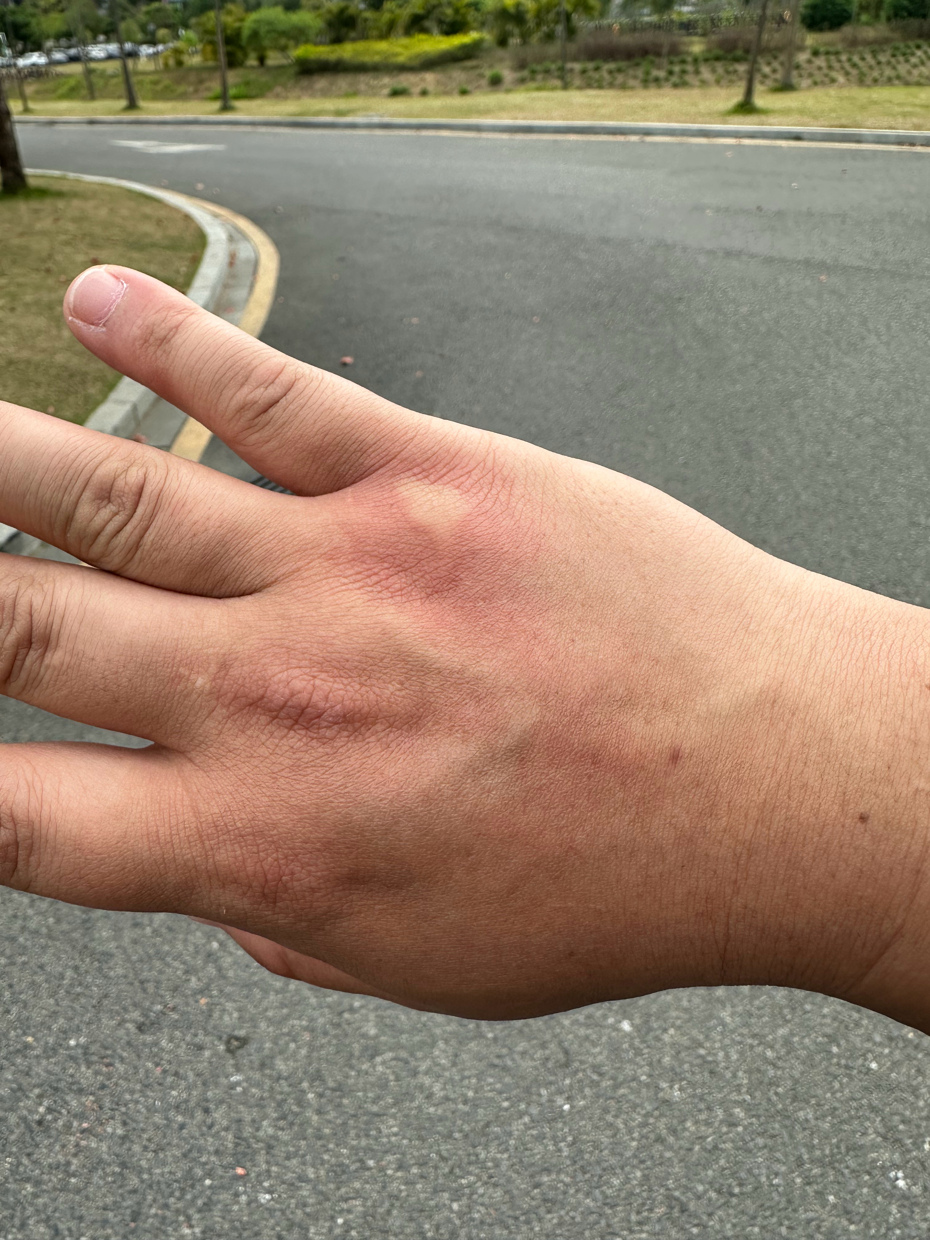 出来拍摄，给虫子咬得不要不要的。