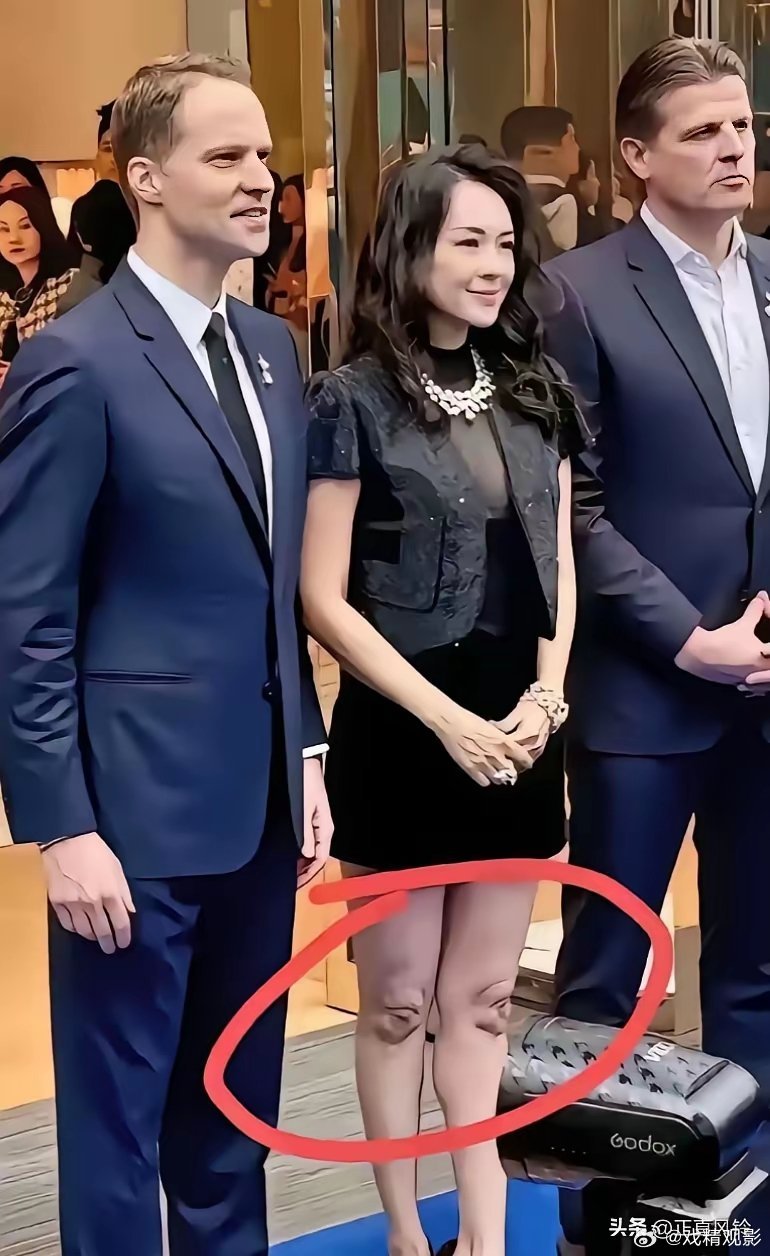 章子怡的膝盖怎么磨成这样了，是不是练瑜伽的就都这样? 膝盖咋象肚脐眼儿？章子怡的