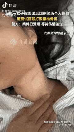 “丧心病狂，必须严惩！”深圳有一女子前往一家单位面试，她将简历递给工作人员后，遭