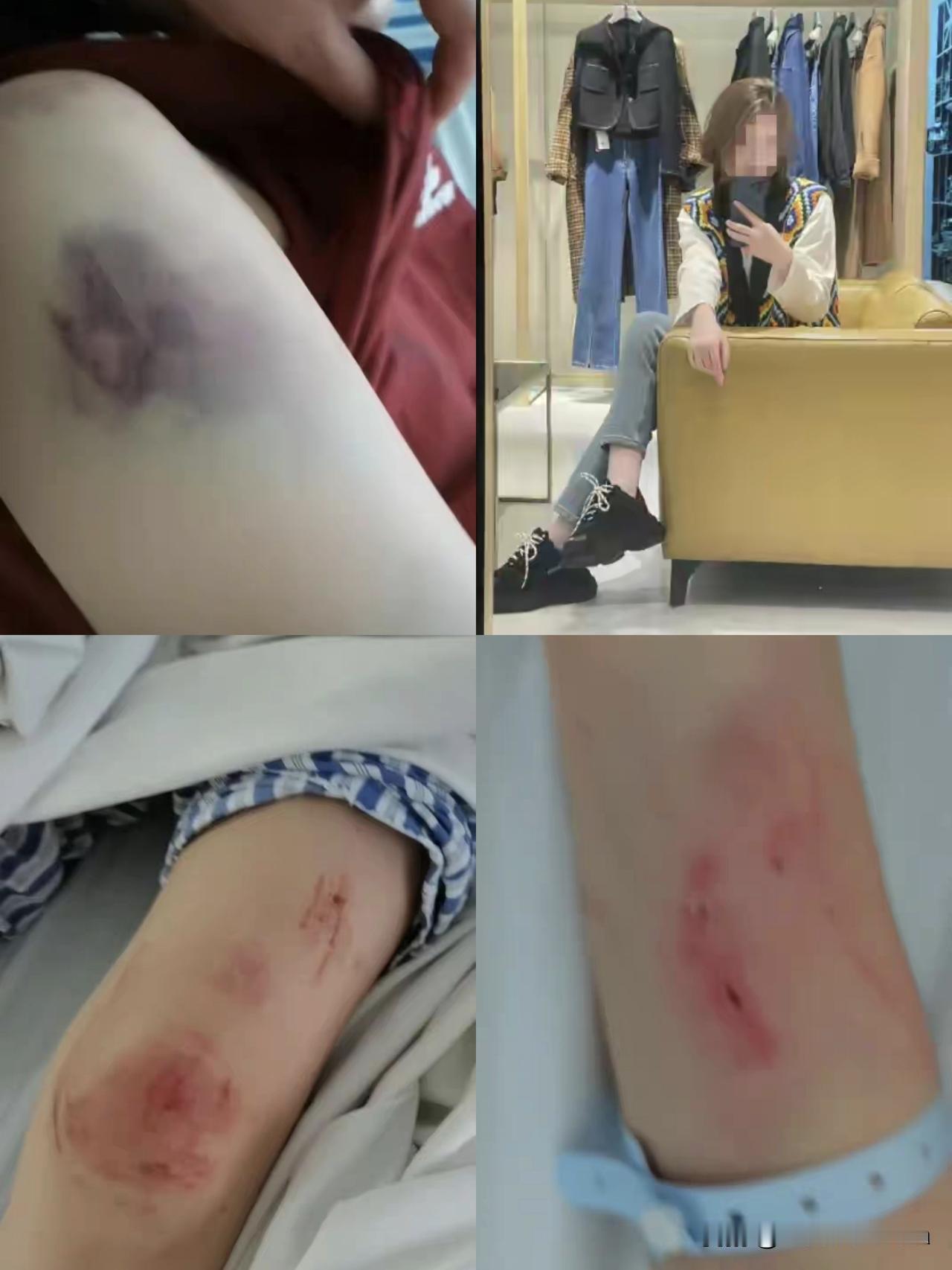 红杏出墙，家破人亡，哪里是什么“女子遭家暴驾车逃跑致丈夫身亡”。

我大量翻阅相