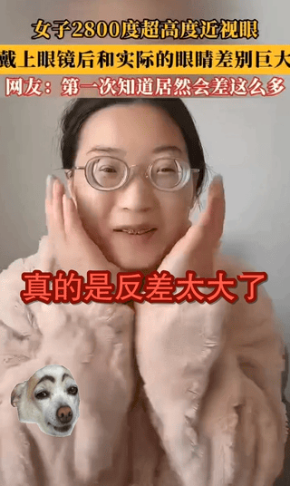 真没想到反差这么大？
戴眼镜和不带眼镜完全两个人，
2800度的镜片能让你的眼睛