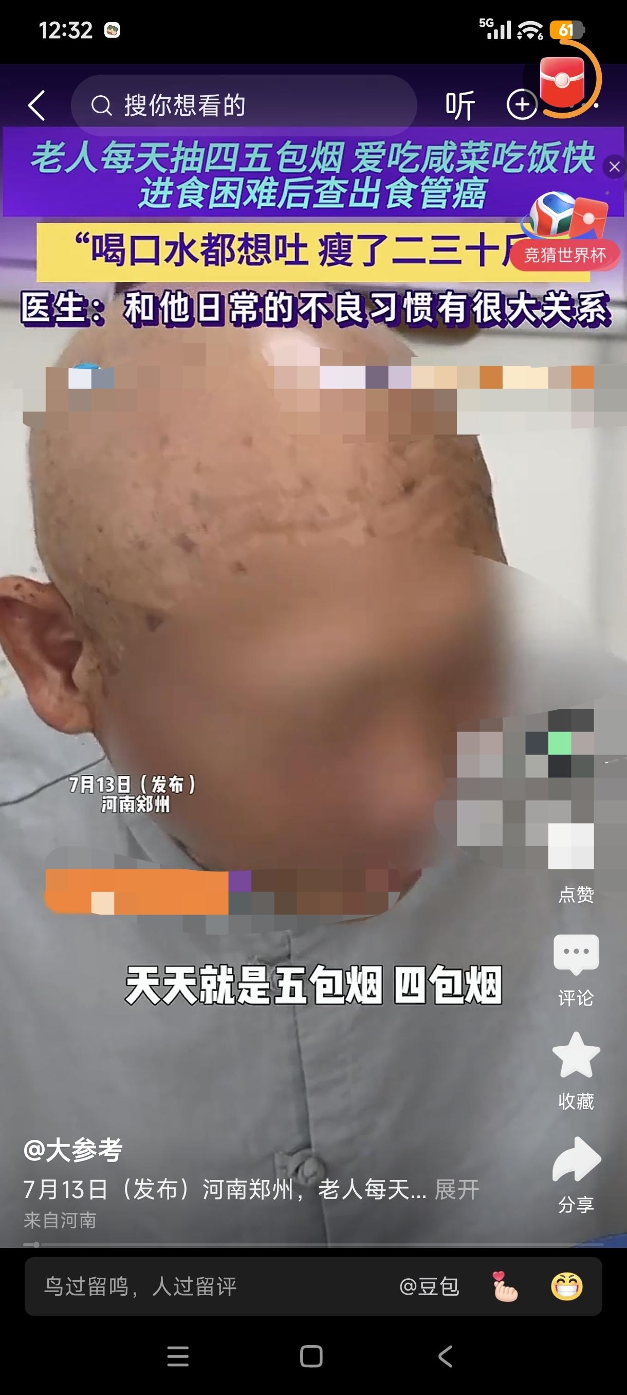 一名河南老人被确诊食管癌，医生告诉他，这跟他的饮食习惯有很大的关系。老人喜欢抽烟