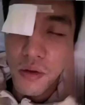 郭艾伦:
如果瞎了，我就不…
篮球运动员郭艾伦
眼睛受伤缝了40多针，
目前正在