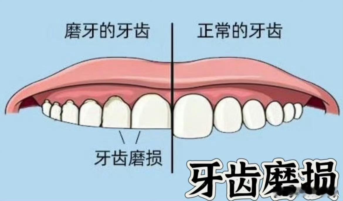 原来这么多年牙齿都在负重前行突然有点羡慕啮齿科的动物，比如小松鼠磨牙是日常。最近