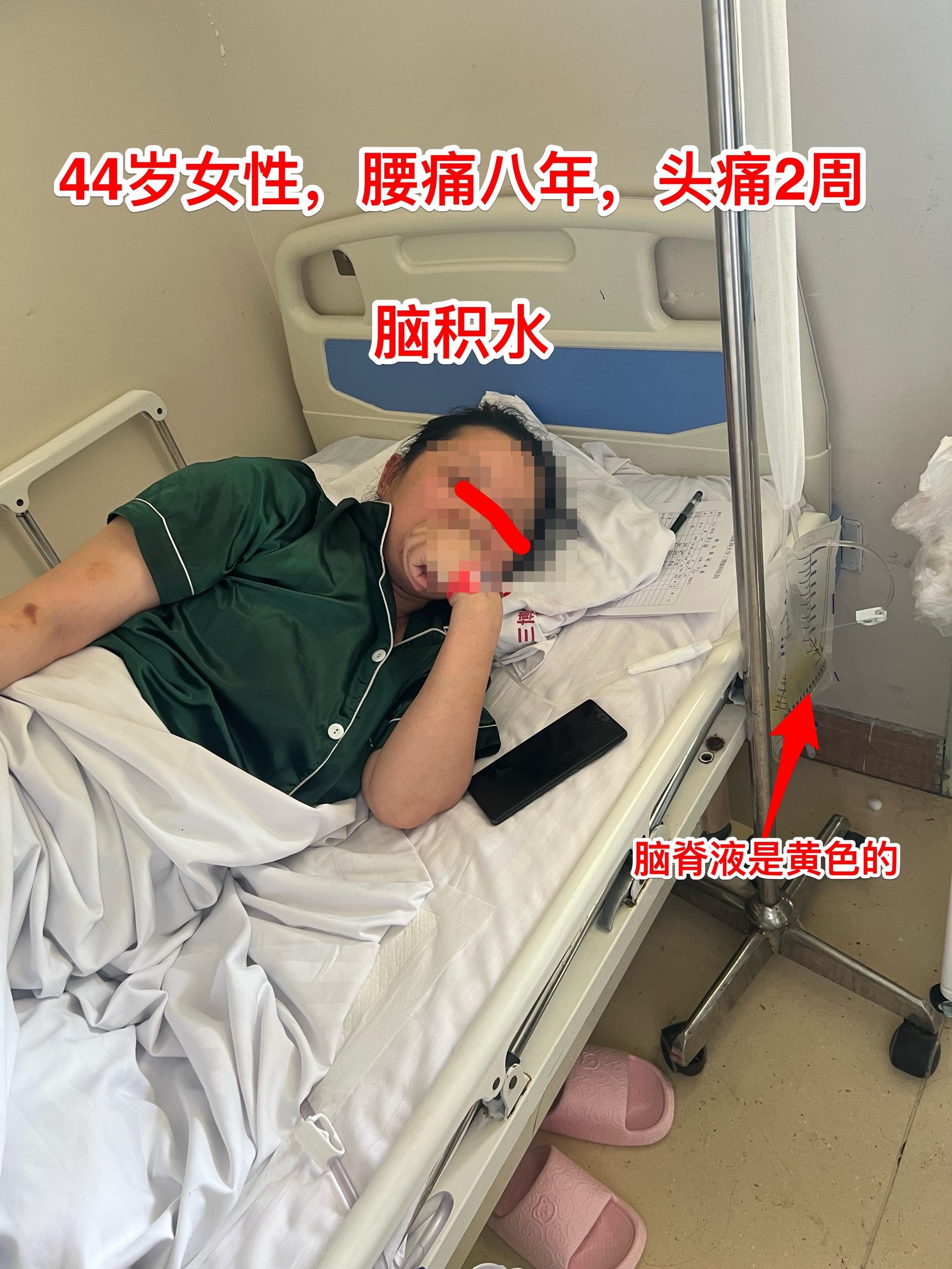 头痛与腰痛有关系吗？脑积水与腰椎有关吗？44岁南阳市女性2周前感到头痛...