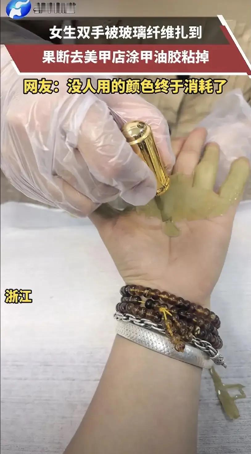 人怎么能这么聪明！浙江，一女子手被玻璃纤维扎到，可她既没有自己拔，也没有去医院，