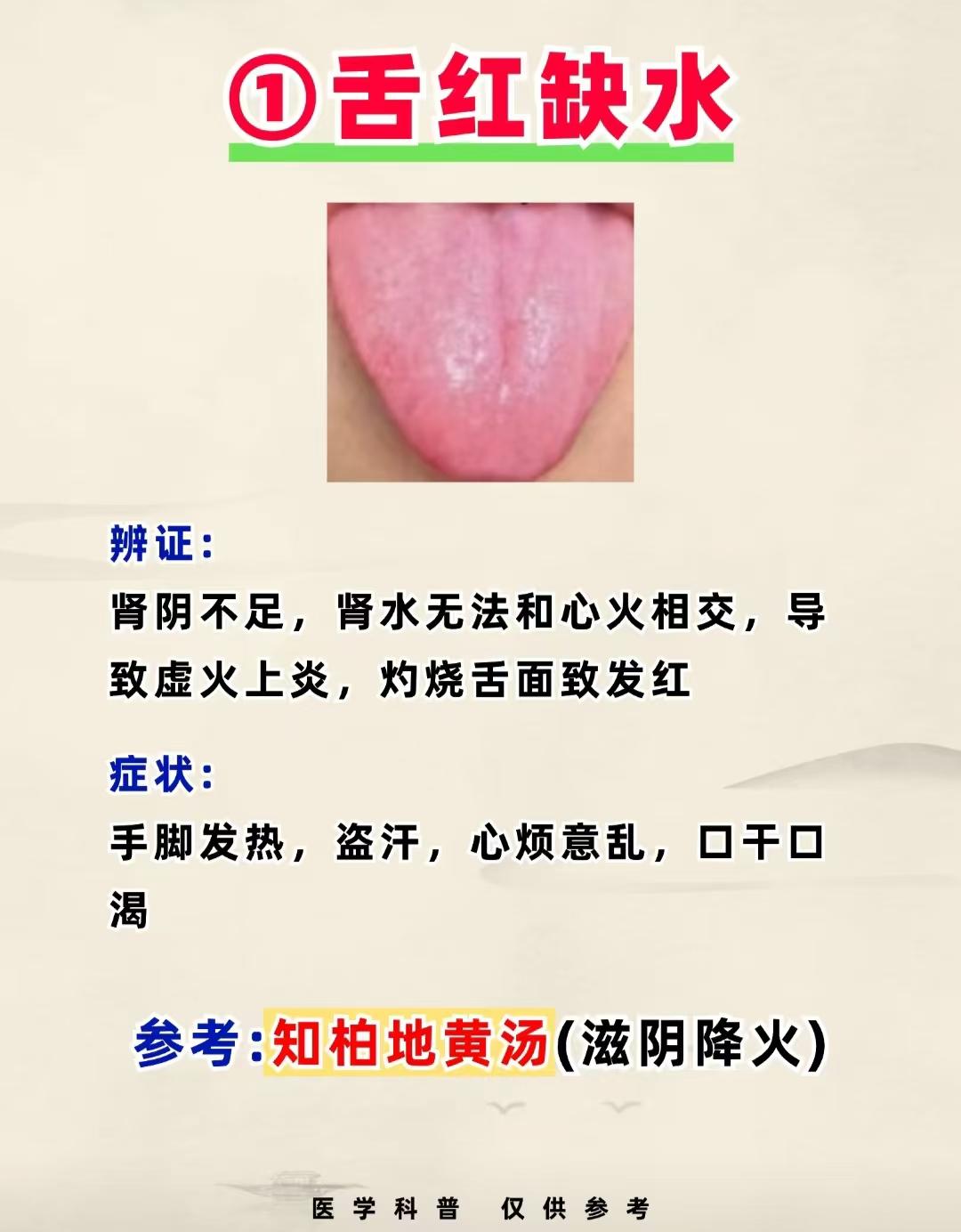 缺水是红舌，缺血是白舌，缺气是胖舌，一文帮你补满气、血、津！