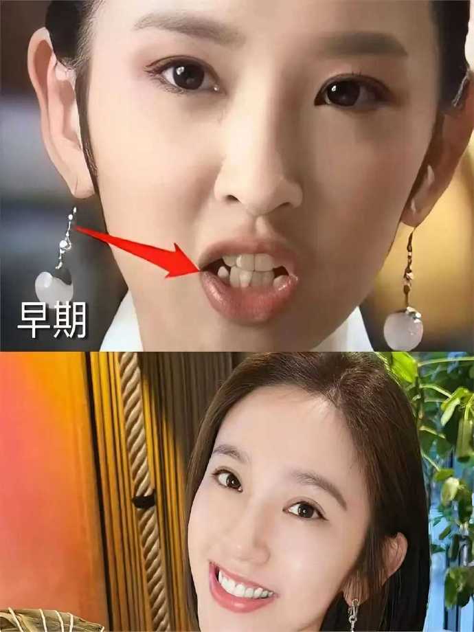 我从来没见过明星戴牙套，牙齿却突然变齐了。 