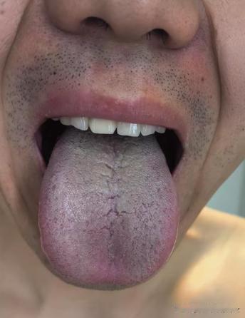 门诊大哥，30来岁，最近感觉不行了，想弄点补药调一调[给力][给力][给力]
但