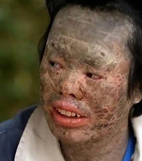 🌙吃蛇太多变蛇人？辽宁村民韩永波爱吃蛇，吃了多年没出事，直到一条黄花松蛇下肚，