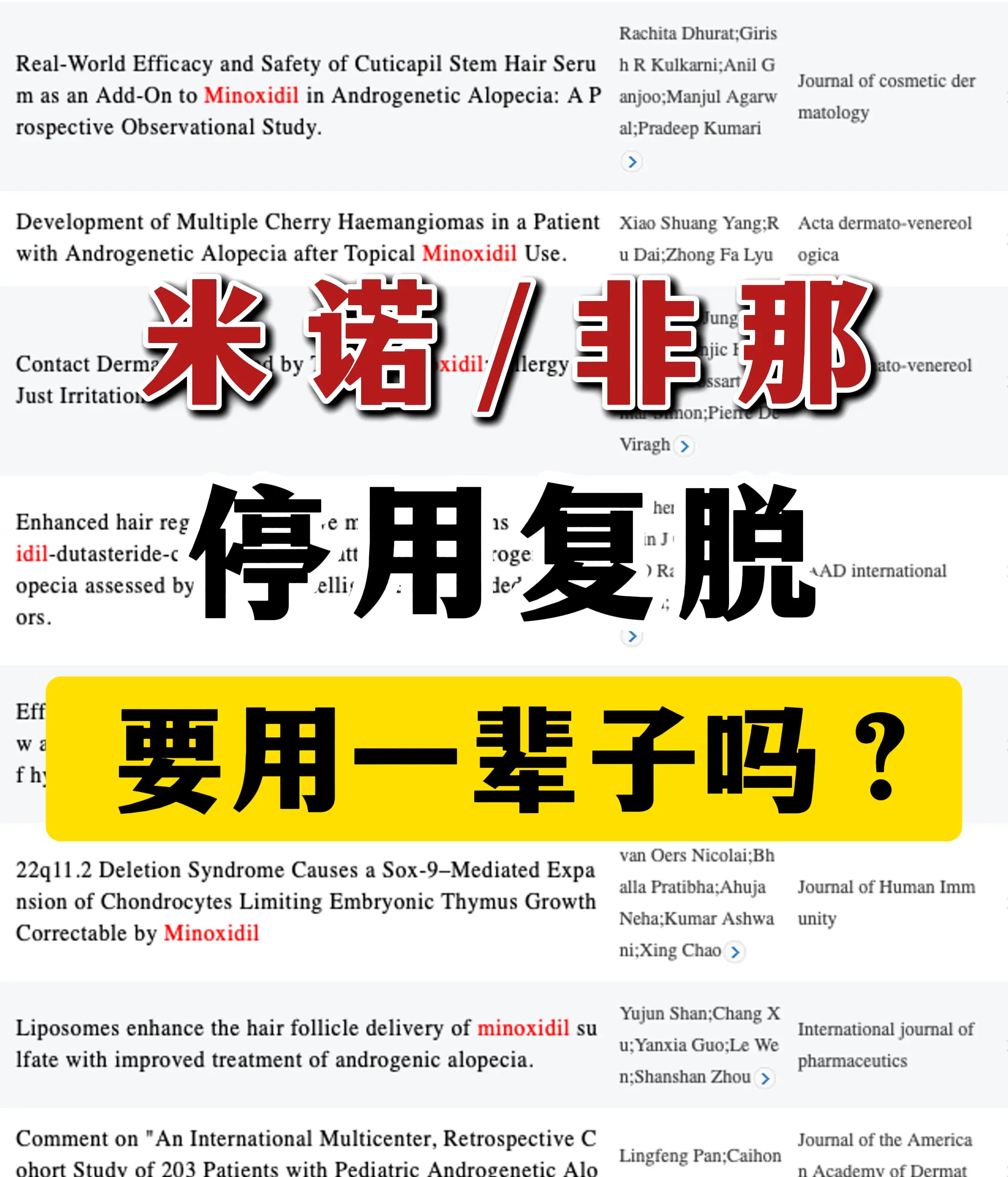 米诺地尔非那雄胺要用一辈子吗？。
