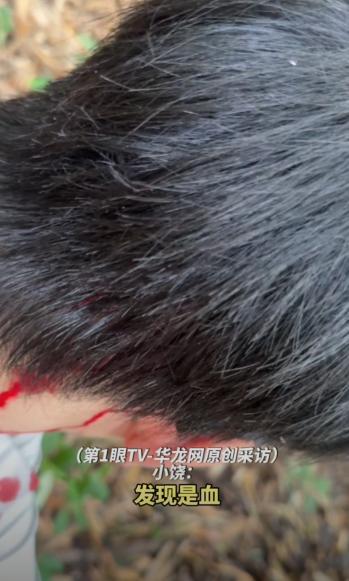 胆子不是一般的大！四川，一男子高兴地进山捡菌子，不料林中突然窜出一只老鹰，对准他