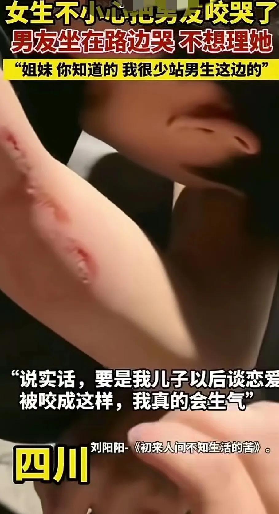 女生不小心咬哭了男友，咬痕这么深，怎么可能是不小心呢。
这男生是有多爱女朋友，才