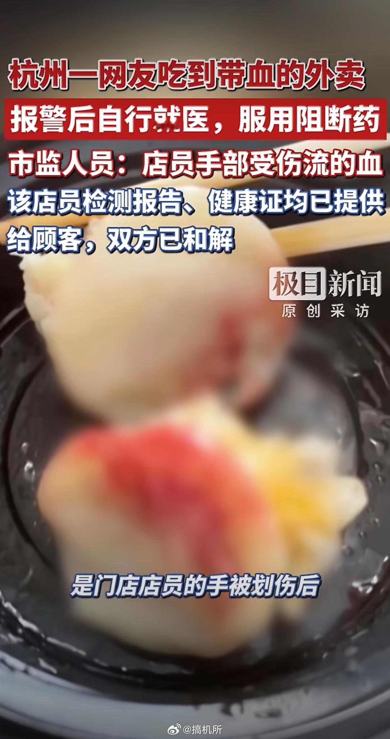 外卖餐食中有血迹顾客紧急服阻断药基本不会感染HIV这类病毒，病毒离体很快就失活了