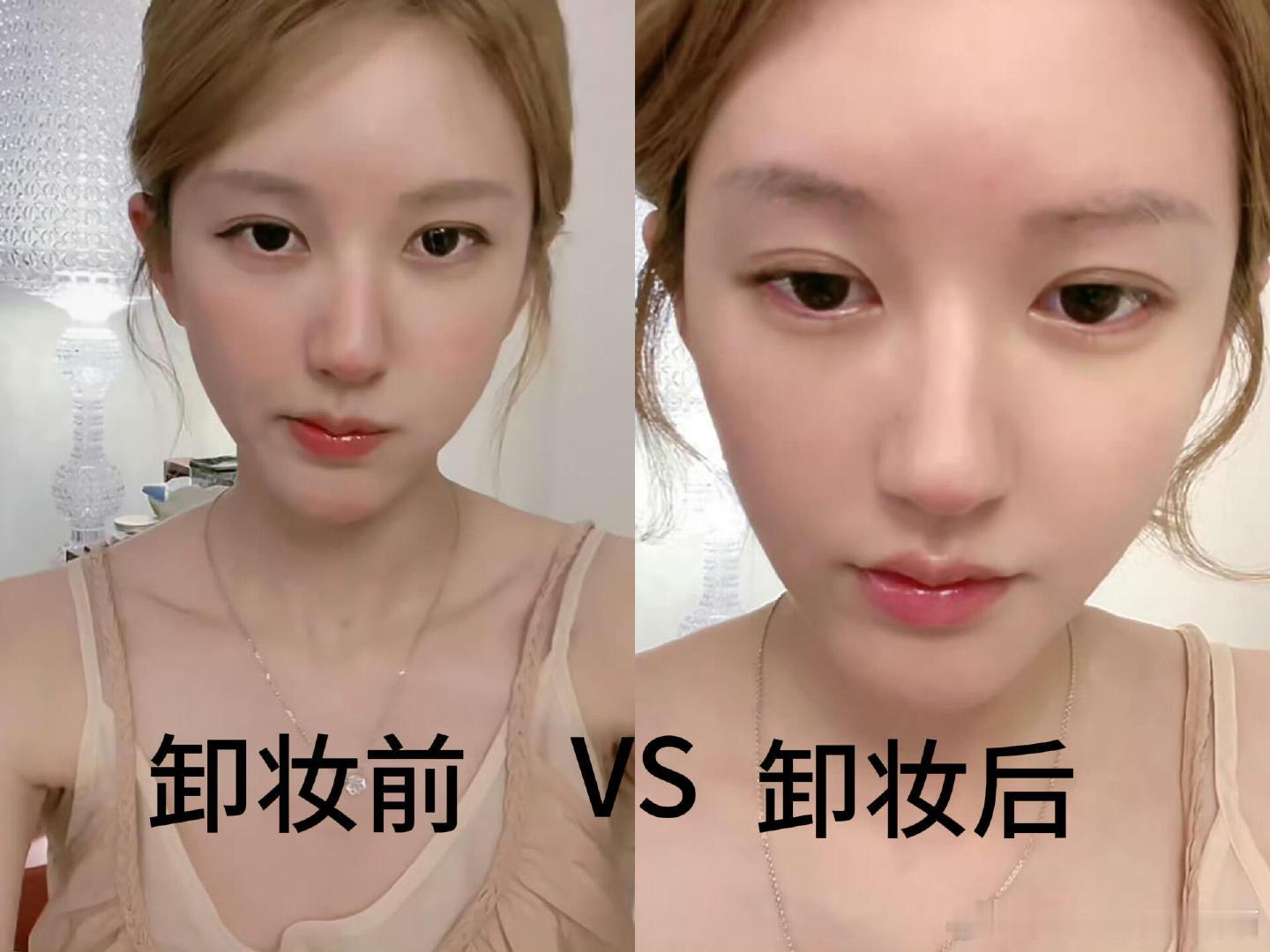赵露思现场直播卸妆赵露思昨天直播卸妆，这个皮肤状态我真心羡慕了。赵露思卸妆前卸妆